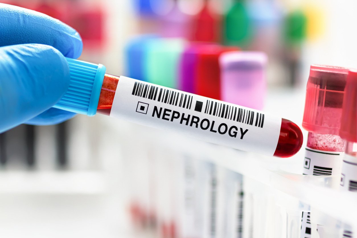 Improve Management of Chronic Kidney Disease with Coordinated Care